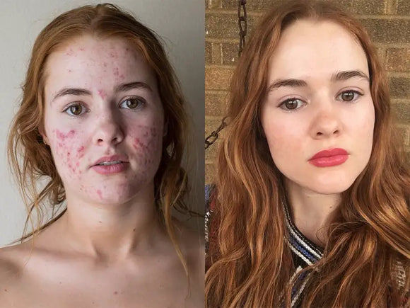 Feature product image